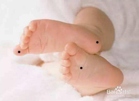 脚底有痣？别当准痣，这3个问题你可能没答案插图