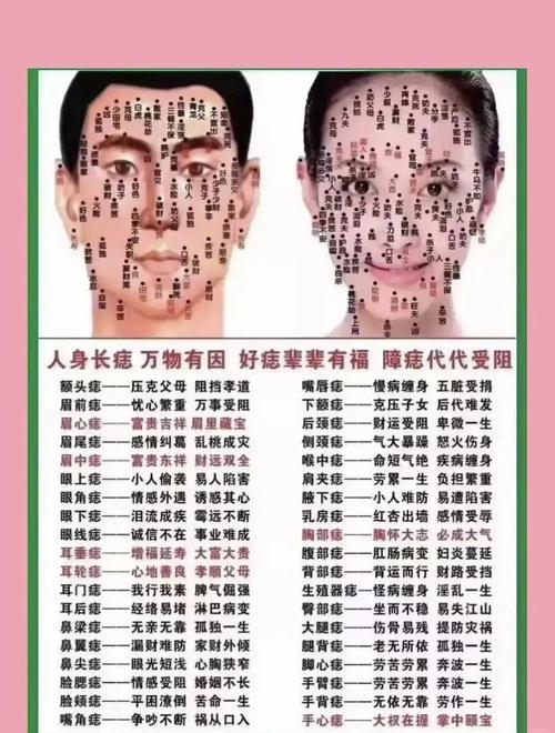 面部痣的利与弊一览表插图 面部痣的利与弊一览表插图
