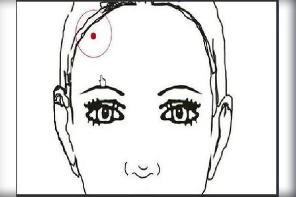 面部痣图解与全解插图