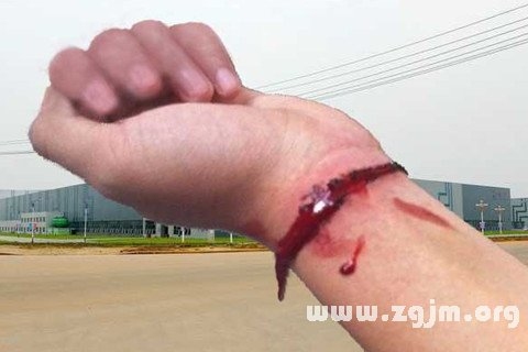 梦到自己割腕自杀,探寻梦境背后的深层含义插图 梦到自己割腕自杀,探寻梦境背后的深层含义插图