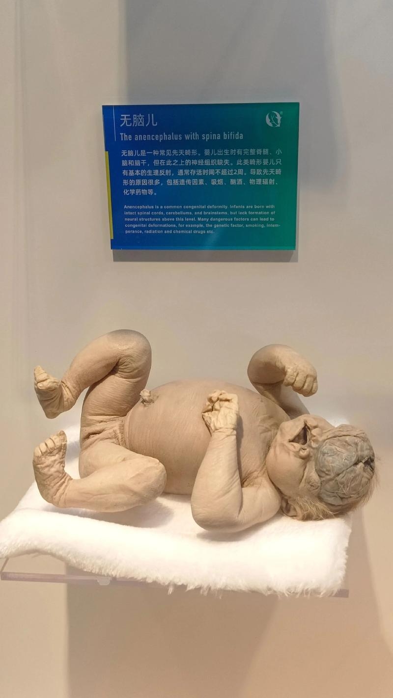 梦回初生，解析梦中婴儿的奥秘插图