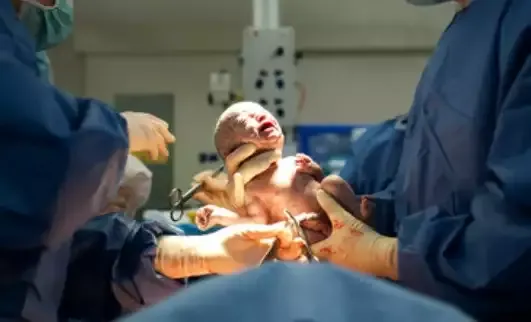 梦见生孩子的寓意与解析插图