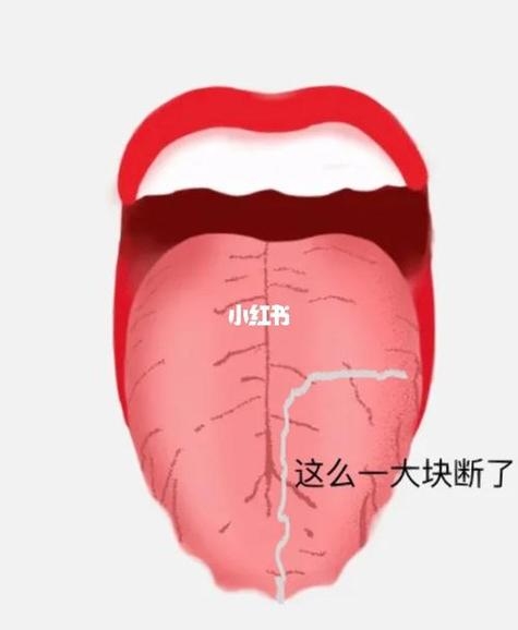 梦见自己舌头掉了，梦境的启示插图