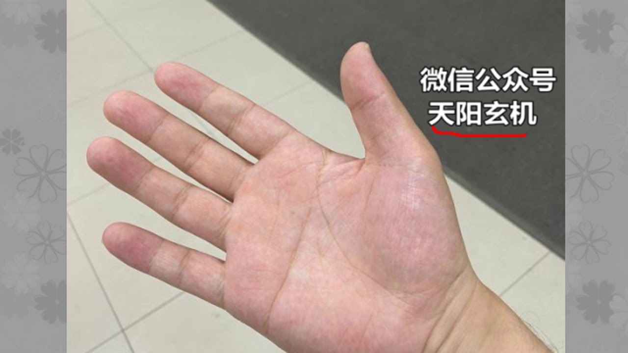 命运的掌纹，断掌女人的坚韧与美丽插图