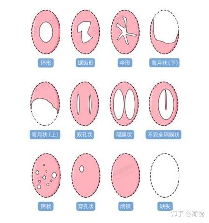 女性B型全覆盖，从生理到心理的全方位认知插图