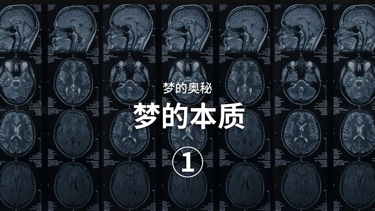 人为什么会做梦？那到底是什么让大脑开启这一奇妙的梦境之旅呢？插图