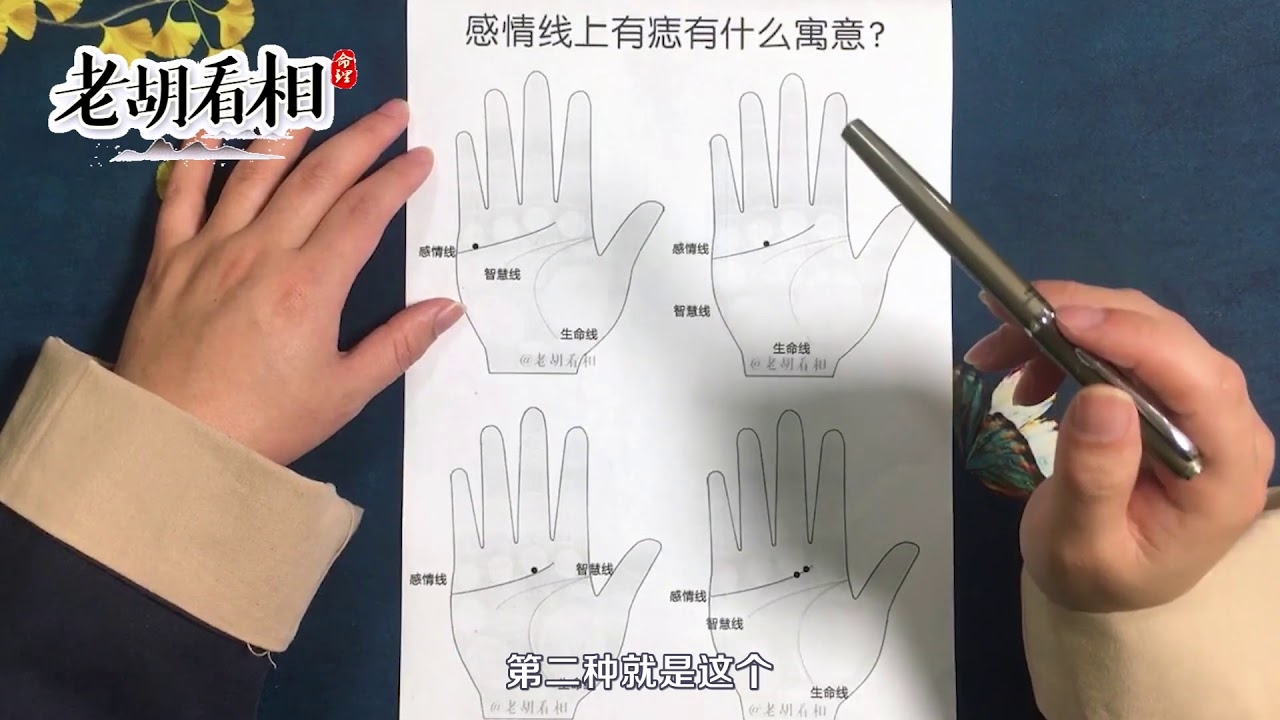 手上痣相图解，探索掌中奥秘，洞悉人生轨迹插图