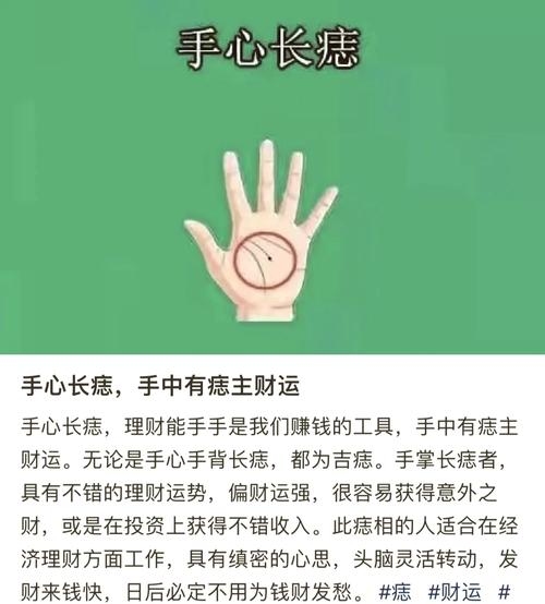 手掌痣寓意与财运事业相关，非直接致癌因素插图