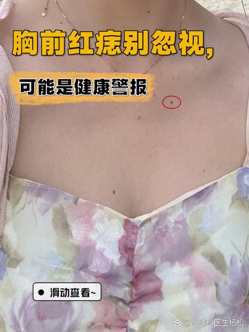 胸前有痣，命运的独特印记插图