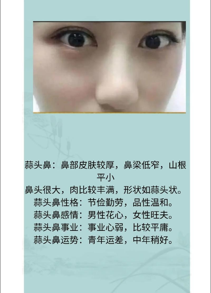 蒜头鼻女性，运势巅峰的旺夫之相插图