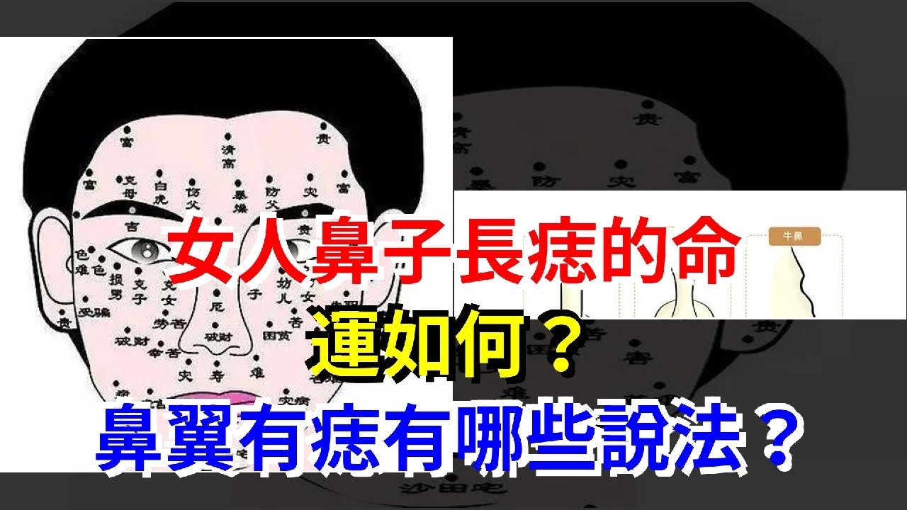 鼻翼两侧长痣，解读命运与美丽的神秘符号插图