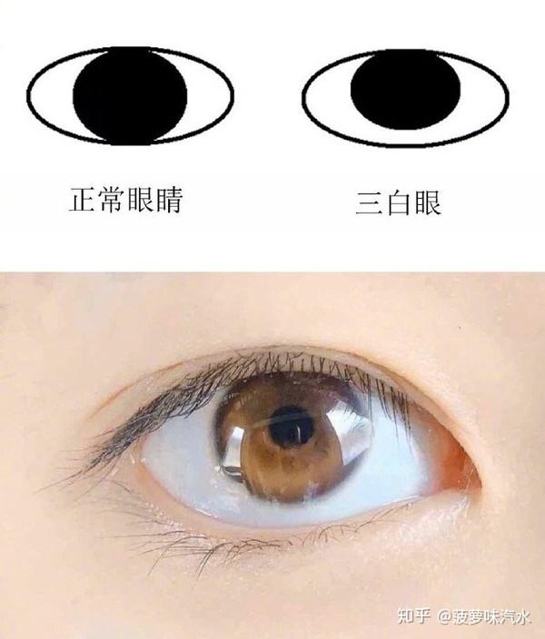 揭秘三白眼,一种独特而复杂的眼神特征插图 揭秘三白眼,一种独特而复杂的眼神特征插图
