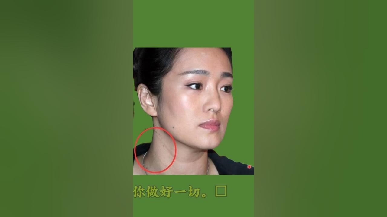 脖子上痣的象征意义插图 脖子上痣的象征意义插图