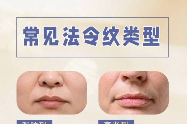 法令纹入口，解锁面部美学的秘密-新乐天