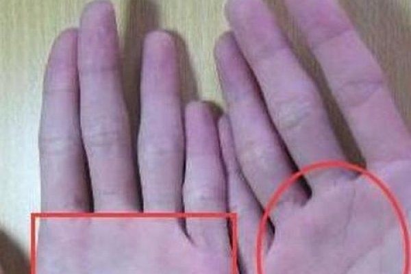 假断掌手相解析，性格坚韧，婚姻美满-新乐天