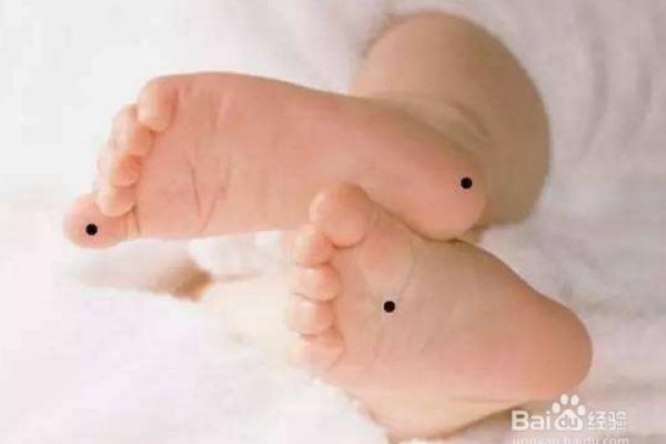 脚底有痣？别当准痣，这3个问题你可能没答案-新乐天