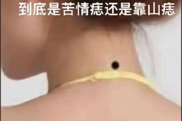 苦情痣，情感的印记与命运的象征-新乐天