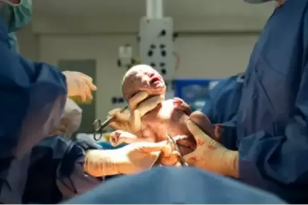 梦见生孩子的寓意与解析-新乐天