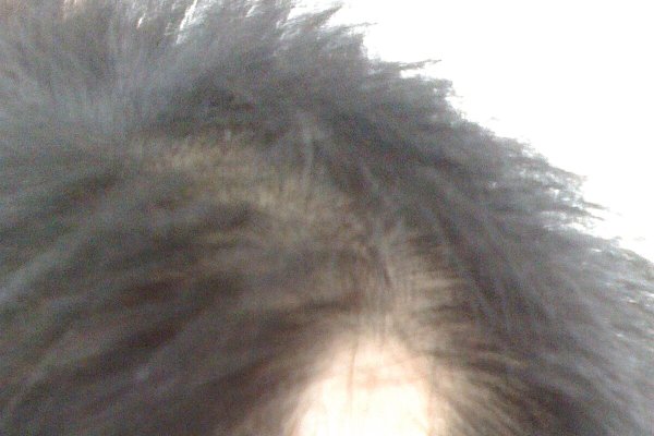 梦见一缕头发轻轻脱落-新乐天