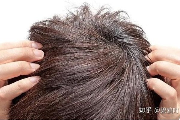 梦见自己长白头发-新乐天