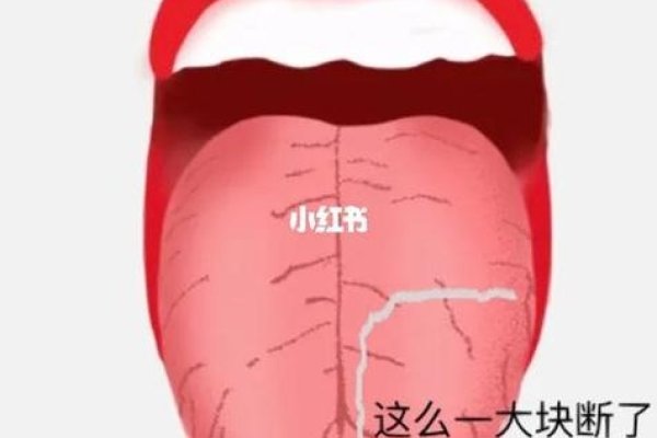 梦见自己舌头掉了,梦境的启示-新乐天