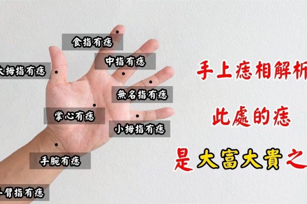 手上痣相图解，揭秘运势吉凶，解读人生轨迹-新乐天