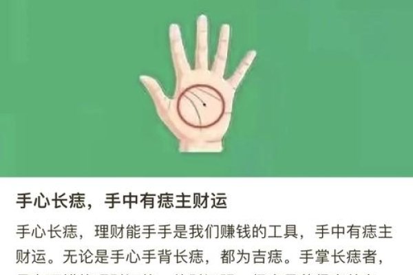 手掌痣寓意与财运事业相关，非直接致癌因素-新乐天