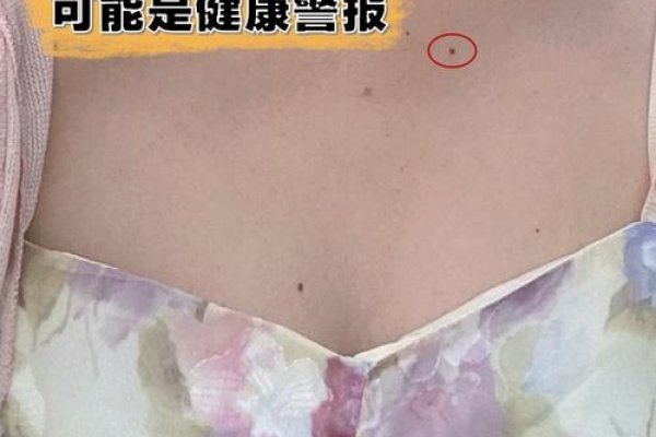 胸前有痣，命运的独特印记-新乐天