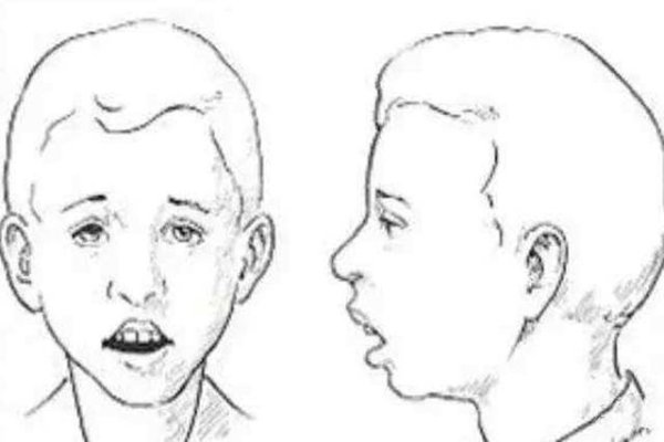 男人面相解析|男怕小嘴女怕大鼻-新乐天