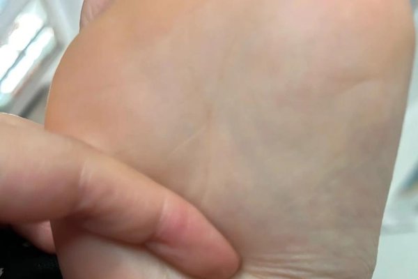 男人右脚底有痣，命运的神秘印记-新乐天