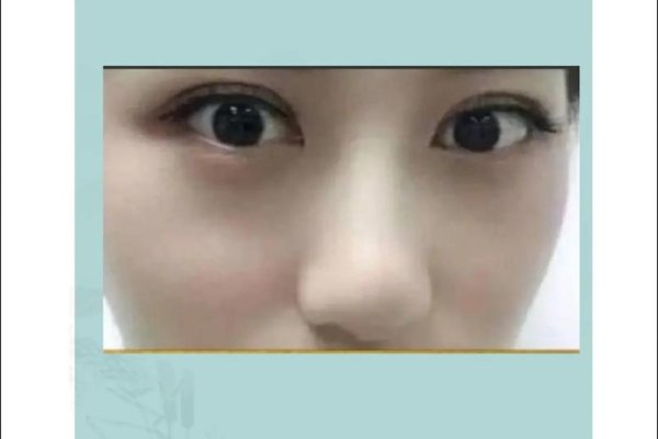 蒜头鼻女性，运势巅峰的旺夫之相-新乐天