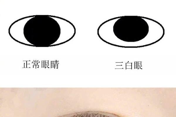 揭秘三白眼，一种独特而复杂的眼神特征-新乐天