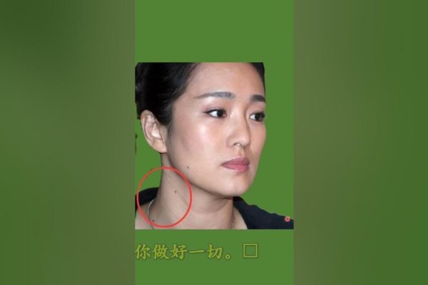脖子上痣的象征意义-新乐天